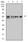 Mouse Monoclonal Antibody to CD2