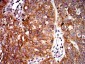Mouse Monoclonal Antibody to UFD1L