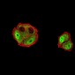 Mouse Monoclonal Antibody to DDX1