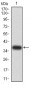 Mouse Monoclonal Antibody to DDX1