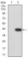 Mouse Monoclonal Antibody to DDX1