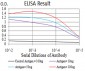 Mouse Monoclonal Antibody to CALB2