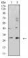 Mouse Monoclonal Antibody to CALB2