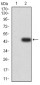 Mouse Monoclonal Antibody to DDX58
