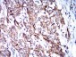 Mouse Monoclonal Antibody to BNIP3