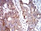 Mouse Monoclonal Antibody to BNIP3