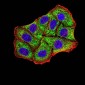 Mouse Monoclonal Antibody to BNIP3