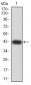 Mouse Monoclonal Antibody to DNTT