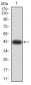 Mouse Monoclonal Antibody to DNTT