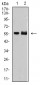 Mouse Monoclonal Antibody to DNTT