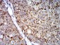 Mouse Monoclonal Antibody to TRIM25