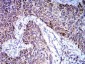 Mouse Monoclonal Antibody to TRIM25