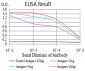 Mouse Monoclonal Antibody to ALK