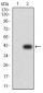 Mouse Monoclonal Antibody to ALK