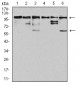 Mouse Monoclonal Antibody to ZFP91