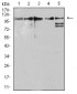 Mouse Monoclonal Antibody to ZFP91