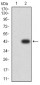 Mouse Monoclonal Antibody to MITF