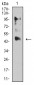 Mouse Monoclonal Antibody to ESRRA