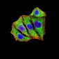 Mouse Monoclonal Antibody to SOD2
