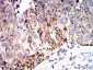 Mouse Monoclonal Antibody to SOD2