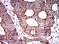 Mouse Monoclonal Antibody to SOD2