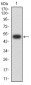 Mouse Monoclonal Antibody to SOD2