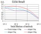 Mouse Monoclonal Antibody to SOD2