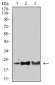 Mouse Monoclonal Antibody to SOD2