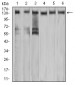 Mouse Monoclonal Antibody to MET