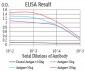 Mouse Monoclonal Antibody to SYK