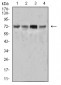 Mouse Monoclonal Antibody to SYK