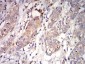 Mouse Monoclonal Antibody to C1QA