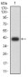 Mouse Monoclonal Antibody to IL1R1