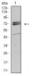 Mouse Monoclonal Antibody to IL1R1