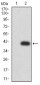 Mouse Monoclonal Antibody to ALK