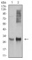 Mouse Monoclonal Antibody to HLA-DRA