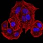 Mouse Monoclonal Antibody to HLA-B