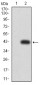 Mouse Monoclonal Antibody to HLA-B