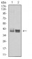 Mouse Monoclonal Antibody to HLA-B