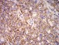 Mouse Monoclonal Antibody to HLA-B