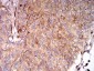 Mouse Monoclonal Antibody to HLA-B