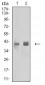 Mouse Monoclonal Antibody to HLA-B