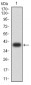 Mouse Monoclonal Antibody to RALB