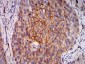 Mouse Monoclonal Antibody to RALB