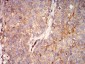 Mouse Monoclonal Antibody to RALB