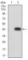 Mouse Monoclonal Antibody to RALB