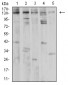 Mouse Monoclonal Antibody to PLCG1