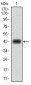 Mouse Monoclonal Antibody to PLCG1