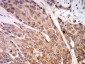 Mouse Monoclonal Antibody to P2RX7