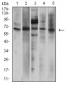 Mouse Monoclonal Antibody to P2RX7